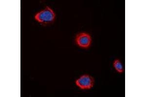 Immunofluorescent analysis of CHRM5 staining in A549 cells. (CHRM5 抗体)