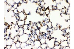 IHC testing of FFPE mouse lung with CD41 antibody. (Integrin Alpha2b 抗体)