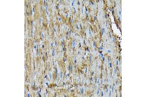 Immunohistochemistry of paraffin-embedded rat heart using HSP20/HSPB6 Rabbit mAb (ABIN7267592) at dilution of 1:100 (40x lens). (HSPB6 抗体)