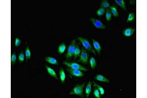 Immunofluorescence (IF) image for anti-Transient Receptor Potential Cation Channel, Subfamily M, Member 2 (TRPM2) (AA 60-119) antibody (ABIN7172859)