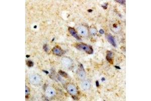 Immunohistochemical analysis of Complement C1QA staining in mouse brain formalin fixed paraffin embedded tissue section. (C1QA 抗体)
