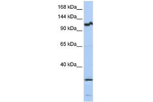 WB Suggested Anti-OSMR Antibody Titration:  0.