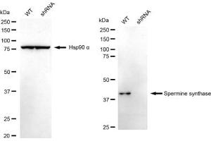 Western blotting analysis using Spermine synthase antibody (ABIN7800420). (Recombinant SMS 抗体)