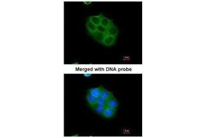 Immunofluorescence (IF) image for anti-Cylindromatosis (Turban Tumor Syndrome) (CYLD) (C-Term) antibody (ABIN2854660)