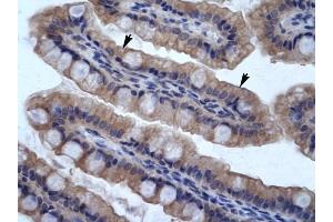 SMPDL3B antibody was used for immunohistochemistry at a concentration of 4-8 ug/ml to stain Epithelial cells of intestinal vilIus (arrows) in Human Intestine. (SMPDL3B 抗体  (N-Term))