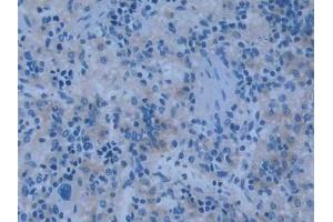 Immunohistochemistry (IHC) image for anti-Nitric Oxide Synthase 2, Inducible (NOS2) (AA 518-694) antibody (ABIN7432718)