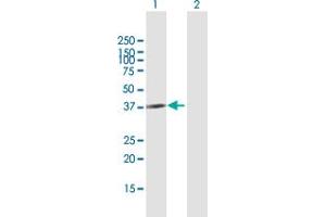 Western Blot analysis of CBX4 expression in transfected 293T cell line by CBX4 MaxPab polyclonal antibody. (CBX4 抗体  (AA 1-290))