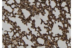 ABIN6274040 at 1/100 staining Mouse lung tissue by IHC-P. (PRC1 抗体  (Internal Region))