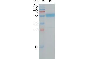 Human IL19 Protein, hFc Tag on SDS-PAGE under reducing condition.