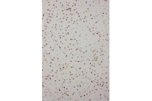 Anti-PDK2 antibody, IHC(P) IHC(P): Rat Brain Tissue (PDK2 抗体  (C-Term))