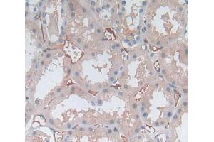 Immunohistochemistry (IHC) image for anti-Membrane Protein, Palmitoylated 2 (MAGUK P55 Subfamily Member 2) (MPP2) (AA 345-573) antibody (ABIN1869269)