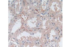 Used in DAB staining on fromalin fixed paraffin- embedded kidney tissue (MPP2 抗体  (AA 345-573))
