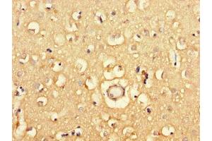 Immunohistochemistry of paraffin-embedded human brain tissue using ABIN7163908 at dilution of 1:100 (Pgap2 抗体  (AA 45-114))