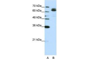 Western Blotting (WB) image for anti-Fragile X Mental Retardation, Autosomal Homolog 1 (FXR1) antibody (ABIN2462084) (FXR1 抗体)