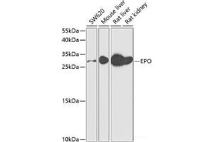 Western blot analysis of extracts of various cell lines using EPO Polyclonal Antibody at dilution of 1:500.