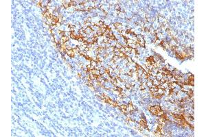 Formalin-fixed, paraffin-embedded human Tonsil stained with CD35 Mouse Monoclonal Antibody (To5). (CD35 抗体)