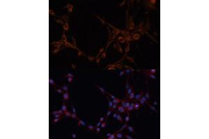 Immunofluorescence analysis of NIH/3T3 cells using  antibody (ABIN6127341, ABIN6136780, ABIN6136781 and ABIN6220209) at dilution of 1:100. (ALDH6A1 抗体  (AA 326-535))