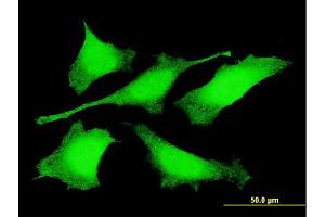 Immunofluorescence of monoclonal antibody to PRDM4 on HeLa cell. (PRDM4 抗体  (AA 476-575))