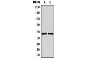 Western blot analysis of TBX22 expression in HeLa (A), Jurkat (B) whole cell lysates. (T-Box 22 抗体  (N-Term))