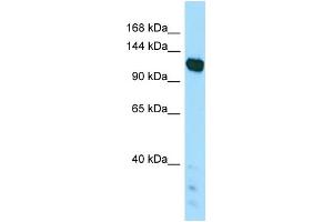 WB Suggested Anti-PAPLN Antibody Titration: 1. (PAPLN 抗体  (C-Term))