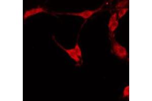 ABIN6274792 staining HT29 by IF/ICC. (EPHX4 抗体  (Internal Region))
