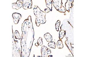 IHC analysis of EML4 using anti-EML4 antibody (ABIN6719384).