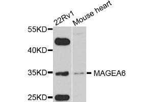 Western blot analysis of extracts of various cell lines, using MAGEA6 antibody. (MAGEA6 抗体)