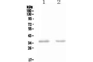 Western blot analysis of NCR1 using anti-NCR1 antibody . (NCR1 抗体  (AA 22-258))