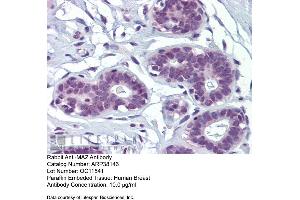 Human Breast (MAZ 抗体  (N-Term))