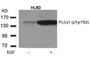 Image no. 1 for anti-phospholipase C, gamma 1 (PLCG1) (pTyr783) antibody (ABIN196792) (Phospholipase C gamma 1 抗体  (pTyr783))