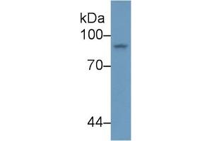 Detection of STAT4 in Human K562 cell lysate using Polyclonal Antibody to Signal Transducer And Activator Of Transcription 4 (STAT4) (STAT4 抗体  (AA 505-737))