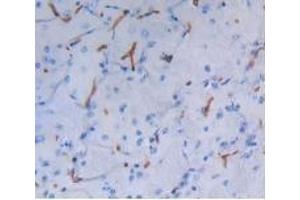 Detection of ALB in Mouse Brain Tissue using Polyclonal Antibody to Albumin (ALB) (Albumin 抗体)