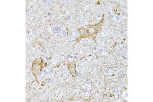 Immunohistochemistry of paraffin-embedded mouse spinal cord using TBCA antibody (ABIN6131384, ABIN6148884, ABIN6148885 and ABIN6216894) at dilution of 1:100 (40x lens).