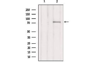 Western blot analysis of extracts from Hepg2, using RHG25 Antibody. (ARHGAP25 抗体  (Internal Region))