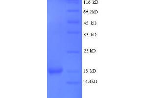 Lens Epithelial Protein (LENEP) (AA 29-164), (partial) protein (His tag) (Lens Epithelial Protein (LENEP) (AA 29-164), (partial) protein (His tag))