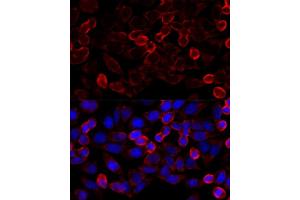 Immunofluorescence analysis of HeLa cells using HD antibody (ABIN6128054, ABIN6141681, ABIN6141684 and ABIN6215131) at dilution of 1:100 (40x lens). (HDAC6 抗体  (AA 836-1104))