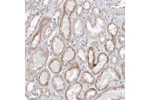 Immunohistochemical staining of human kidney with ZYG11B polyclonal antibody  shows cytoplasmic positivity in cells of tubules. (ZYG11B 抗体)
