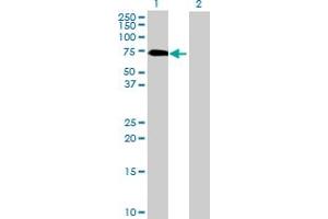 Western Blotting (WB) image for anti-Golgi-Associated, gamma Adaptin Ear Containing, ARF Binding Protein 1 (GGA1) (AA 1-552) antibody (ABIN525583)
