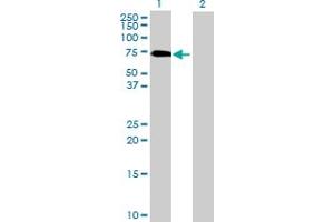 Western Blot analysis of GGA1 expression in transfected 293T cell line by GGA1 MaxPab polyclonal antibody. (GGA1 抗体  (AA 1-552))