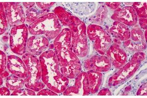 Human Kidney: Formalin-Fixed, Paraffin-Embedded (FFPE) (RAE1 抗体  (C-Term))