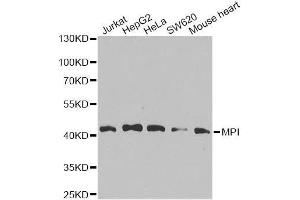 Western blot analysis of extracts of various cell lines, using MPI antibody. (MPI 抗体  (AA 1-423))