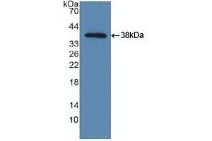 Detection of Recombinant TBK1, Human using Polyclonal Antibody to TANK Binding Kinase 1 (TBK1) (TBK1 抗体  (AA 9-310))