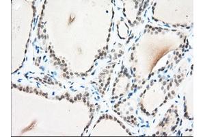 Immunohistochemical staining of paraffin-embedded Human Kidney tissue using anti-USP5 mouse monoclonal antibody. (USP5 抗体)
