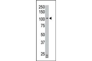 The anti-PTPIA2 beta N-term Pab (ABIN392840 and ABIN2842265) is used in Western blot to detect PTPIA2 beta in C6 cell lysate.