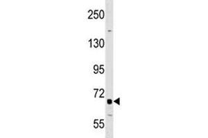 Western Blotting (WB) image for anti-Tumor Necrosis Factor Receptor Superfamily, Member 21 (TNFRSF21) (AA 356-385) antibody (ABIN3029370)