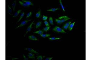 Immunofluorescence staining of Hela Cells with ABIN7127446 at 1:50, counter-stained with DAPI. (Recombinant CYP17A1 抗体)