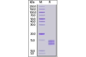 SDS-PAGE (SDS) image for Tumor Necrosis Factor Receptor Superfamily, Member 17 (TNFRSF17) (AA 1-49) (Active) protein (His tag) (ABIN5954937)
