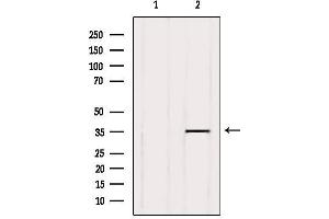 Western blot analysis of extracts from Hela, using GPR141 Antibody. (GPR141 抗体  (Internal Region))