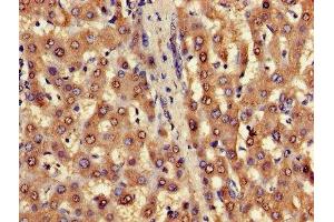 Immunohistochemistry of paraffin-embedded human liver tissue using ABIN7153223 at dilution of 1:100 (FUOM 抗体  (AA 1-134))