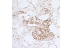 Immunohistochemistry (IHC) image for anti-Major Vault Protein (MVP) (AA 1-50) antibody (ABIN7455064) (MVP 抗体  (AA 1-50))